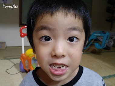 子供の成長♪ 歯が抜けた~ 子供の成長♪ 歯が抜けた~