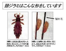 しらみ 豊見城市 豊崎 美容室 Aube オーブ