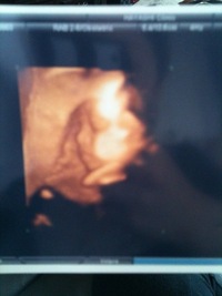 29w4d♡