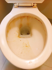 トイレの黄ばみ&尿石