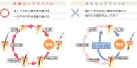 事前ケア！