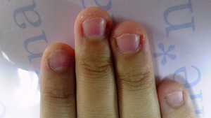 爪噛み・深爪・爪陥没・二枚爪・薄い爪、割れる爪・改善します。沖縄市のお店です